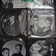 Music Albums